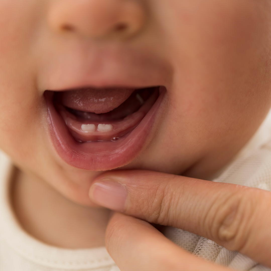 Teething- what to expect and how to navigate it